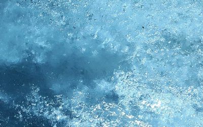 Cryosauna y EMS